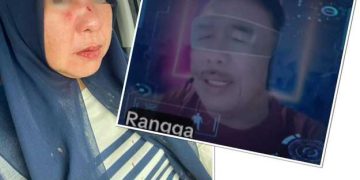 Korban Luka Penganiayaan di LU Keberatan Jika Pelaku di Tangguhkan