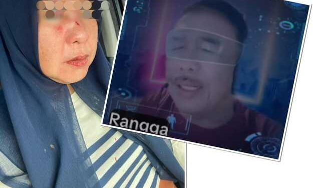 Korban Luka Penganiayaan di LU Keberatan Jika Pelaku di Tangguhkan