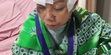 Terbentur Birokrasi Dinsos Pringsewu, Penjual Kue Korban Kecelakaan Terancam Tagihan Medis Rp100 Juta