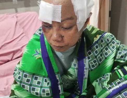 Terbentur Birokrasi Dinsos Pringsewu, Penjual Kue Korban Kecelakaan Terancam Tagihan Medis Rp100 Juta