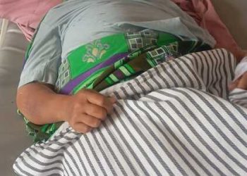 RS Yukum Medical Bantu Ringankan Biaya Meli, Korban Lakalantas di Lamteng 