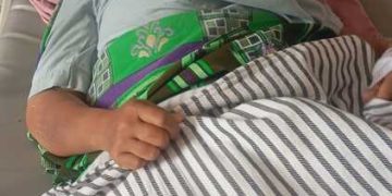 RS Yukum Medical Bantu Ringankan Biaya Meli, Korban Lakalantas di Lamteng 