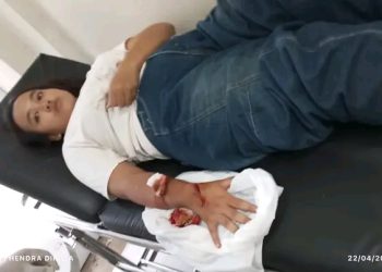 Lampung Utara Mencekam! IRT Asal Ratu Abung Jadi Korban Begal Sadis, Tangan Dibacok dan Motor Raib