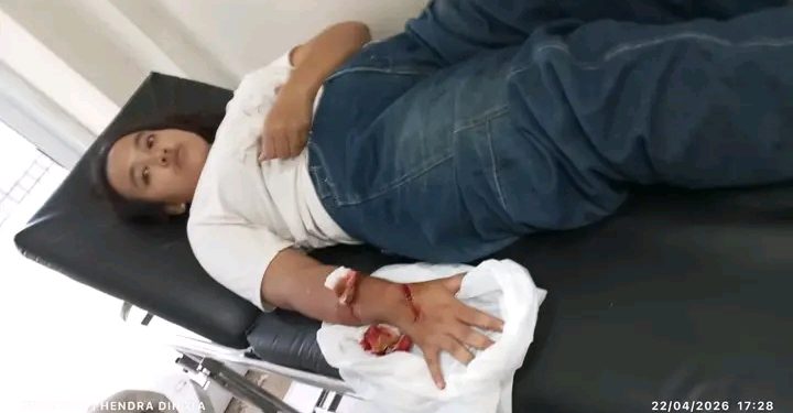 Lampung Utara Mencekam! IRT Asal Ratu Abung Jadi Korban Begal Sadis, Tangan Dibacok dan Motor Raib